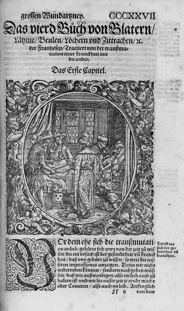 Paracelsus Paracelsus - Woodcut from: Theophrast Paracelsus: Opus chyrurgicum. Wund und Artzney Buch … in Truck gegeben Durch Adamum von Bodenstein, Frankfurt, Martin Lechler für Sigmund Feyerabend un