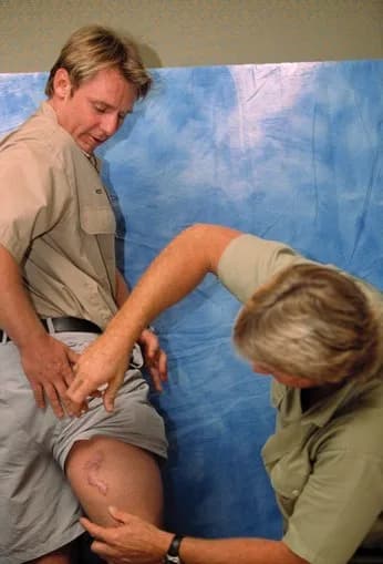 Steve Irwin - Wes Mannion and Steve Irwin showing Wes's crocodile attack scar