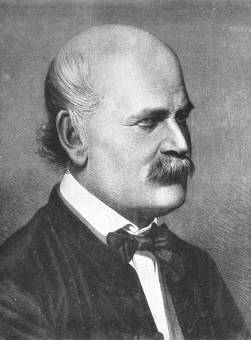 Ignaz Semmelweis - Ignaz Semmelweis in 1860