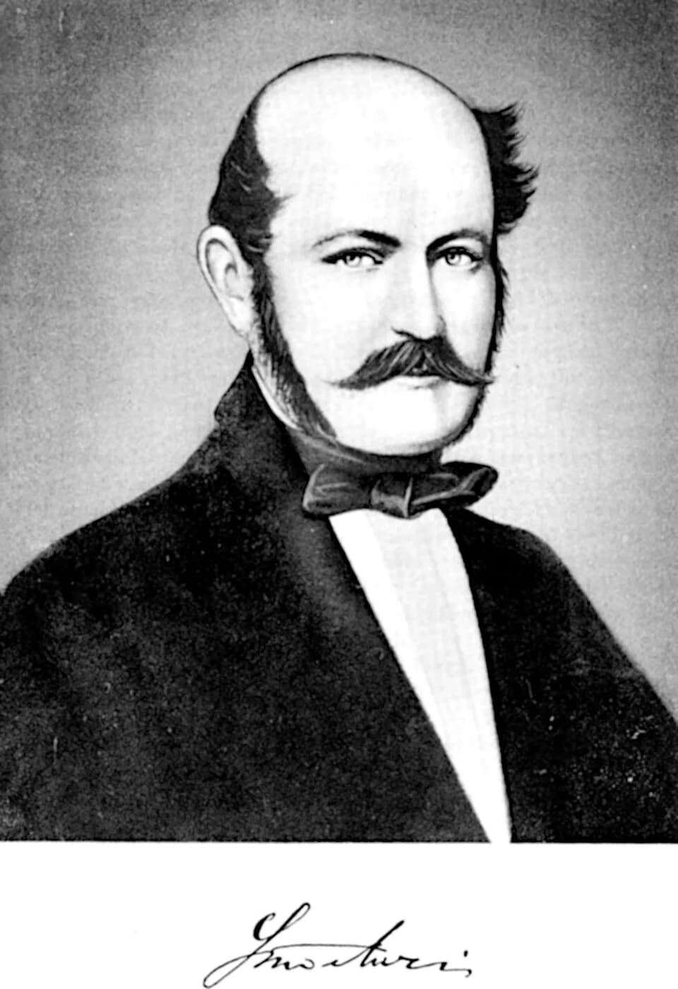 Ignaz Semmelweis - Ignaz Semmelweis potrait, probably based on 1857 aquarelle by Àgost Canzi