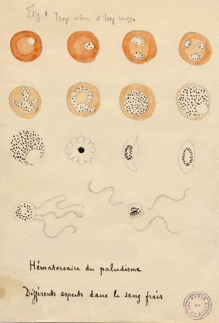 Charles Louis Alphonse Laveran - Illustration drawn by Laveran of various stages of malaria parasites as seen on fresh blood. Dark pigment granules are present in most stages. The bottom row shows an