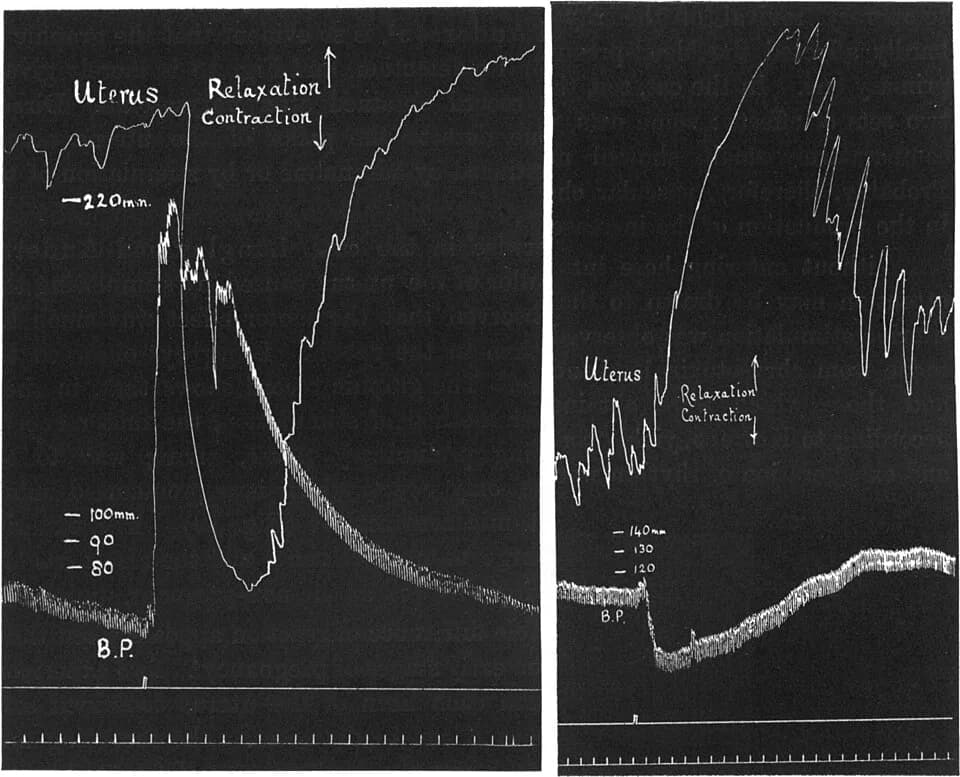 Henry Hallett Dale - From Dale's paper J. Physiol. 1906: an ergot extract reverses the effect of adrenaline on blood pressure and uterus in an anaesthetized cat