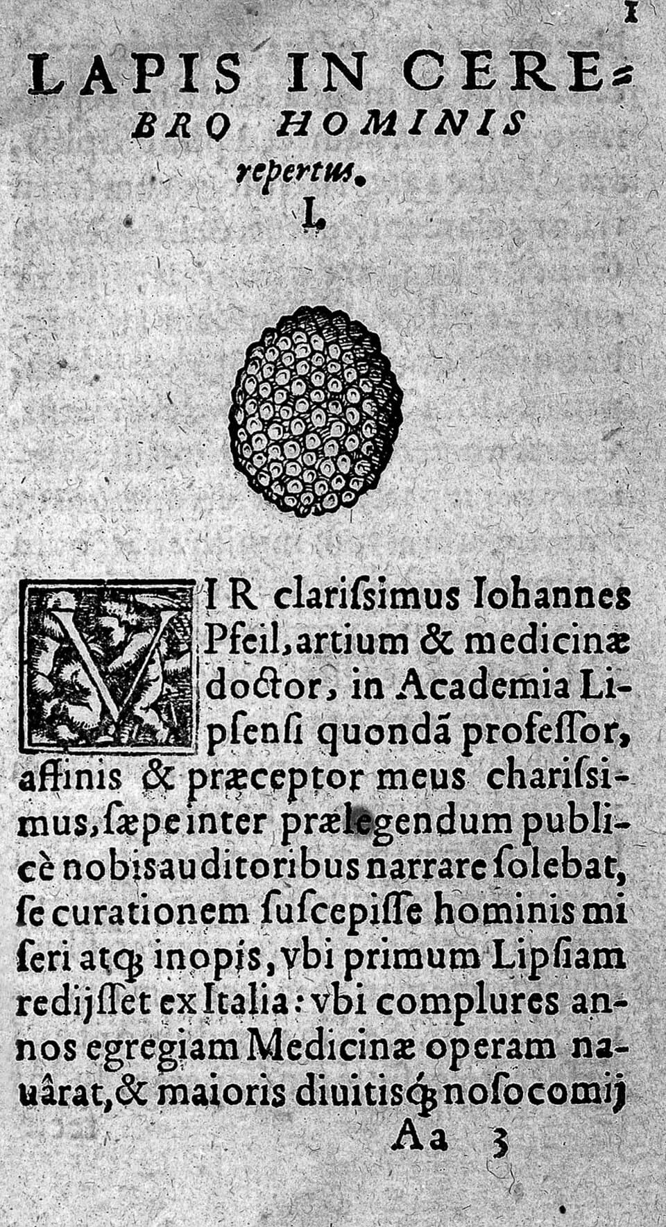 Conrad Gessner - Calcified tumour of the brain

Rare Books
Keywords: Anatomy; Konrad Gesner